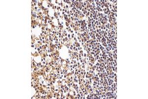 (ABIN1944779 and ABIN2838521) staining HLA-B in human tonsil tissue sections by Immunohistochemistry (IHC-P - paraformaldehyde-fixed, paraffin-embedded sections). (HLA-B anticorps  (N-Term))