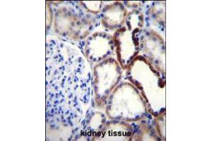 NKD2 Antibody immunohistochemistry analysis in formalin fixed and paraffin embedded human kidney tissue followed by peroxidase conjugation of the secondary antibody and DAB staining. (NKD2 anticorps  (C-Term))