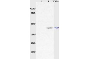 Lane 1: rat lung lysates Lane 2: human colon carcinoma lysates probed with Anti CD64/IGFR1/FCGR1A Polyclonal Antibody, Unconjugated (ABIN747413) at 1:200 in 4 °C.