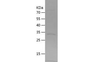 Western Blotting (WB) image for Enoyl-CoA Delta Isomerase 1 (ECI1) (AA 42-302) protein (His tag) (ABIN7122794)