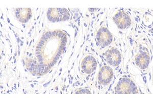 Detection of MMP13 in Porcine Uterus Tissue using Polyclonal Antibody to Matrix Metalloproteinase 13 (MMP13) (MMP13 anticorps  (AA 123-270))