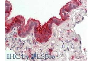 IHC-P analysis of Human Lung Tissue, with HE staining. (SCGB1A1 anticorps  (AA 23-91))
