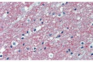 Detection of PDL2 in Human Cerebrum Tissue using Polyclonal Antibody to Programmed Cell Death Protein 1 Ligand 2 (PDL2) (PDCD1LG2 anticorps  (AA 36-219))