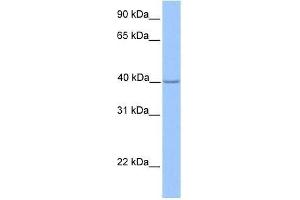 ZNF385D antibody used at 0. (ZNF385D anticorps  (N-Term))