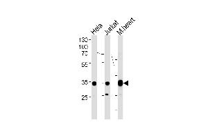 NDUFA9 Antibody (Center) (ABIN1881568 and ABIN2838471) western blot analysis in Hela,Jurkat cell line and mouse heart tissue lysates (35 μg/lane).