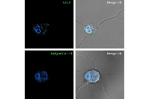 Live Cell Imaging (LCI) image for anti-Solute Carrier Family 2 (Facilitated Glucose Transporter), Member 1 (SLC2A1) (1st Extracellular Loop), (AA 41-55) antibody (ABIN7886492)
