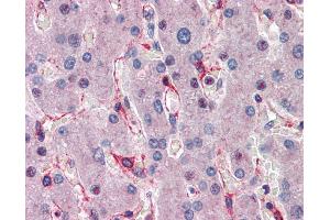 Immunohistochemistry (IHC) image for anti-E3 Ubiquitin-Protein Ligase SIAH1 (SIAH1) (C-Term) antibody (ABIN2780459)