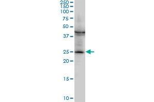 GSTM2 monoclonal antibody (M03), clone 1E10. (GSTM2 anticorps  (AA 90-189))