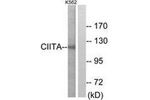 Western Blotting (WB) image for anti-Class II, Major Histocompatibility Complex, Transactivator (CIITA) (AA 706-755) antibody (ABIN2889454) (CIITA anticorps  (AA 706-755))