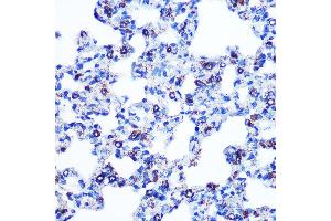 Immunohistochemistry of paraffin-embedded rat lung using Monoamine Oxidase B (MAOB) (MAOB) Rabbit mAb (ABIN7268682) at dilution of 1:100 (40x lens). (Monoamine Oxidase B anticorps)