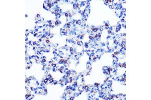 Immunohistochemistry of paraffin-embedded rat lung using Monoamine Oxidase B (MAOB) (MAOB) Rabbit mAb (ABIN7268682) at dilution of 1:100 (40x lens).