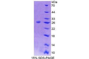 SDS-PAGE (SDS) image for B-Cell CLL/lymphoma 9 (BCL9) (AA 1118-1327) protein (His tag) (ABIN1981165)