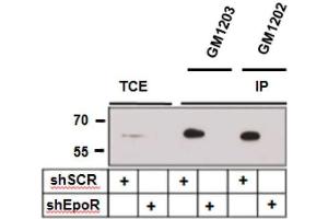 Immunoprecipitation of EpoR with and from A549 lung carcinoma cells expressing control (shSCR) and three EpoR-specific small hairpin RNAs (shEpoR).