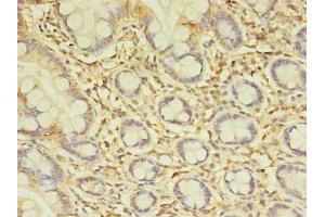 Immunohistochemistry of paraffin-embedded human small intestine tissue using ABIN7172654 at dilution of 1:100 (SPIC anticorps  (AA 1-248))