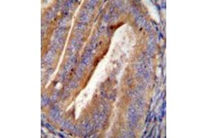Immunohistochemistry analysis in formalin fixed and paraffin embedded human uterus tissue reacted with OGN Antibody (C-term)  followed by peroxidase conjugation of the secondary antibody and DAB staining. (OGN anticorps  (C-Term))