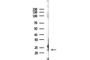 anti-Breast Carcinoma Amplified Sequence 4 (BCAS4) antibody