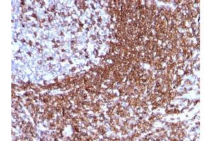 Formalin-fixed, paraffin-embedded human Tonsil stained with CD50 Mouse Monoclonal Antibody (186-2G9). (ICAM-3/CD50 anticorps)