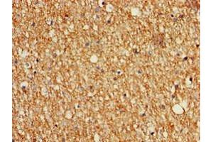 Immunohistochemistry of paraffin-embedded human brain tissue using ABIN7159980 at dilution of 1:100