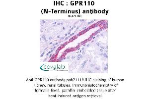 Image no. 1 for anti-G Protein-Coupled Receptor 110 (GPR110) (Extracellular Domain), (N-Term) antibody (ABIN1734904) (G Protein-Coupled Receptor 110 anticorps  (Extracellular Domain, N-Term))