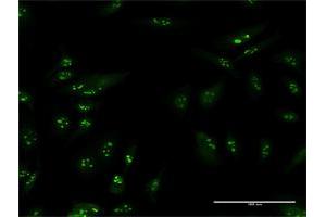 Immunofluorescence of purified MaxPab antibody to TSPYL6 on HeLa cell. (TSPY-Like 6 anticorps  (AA 1-410))