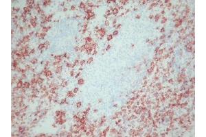 Immunohistochemistry (IHC) image for anti-Macrophages antibody (ABIN781726) (Macrophages anticorps)