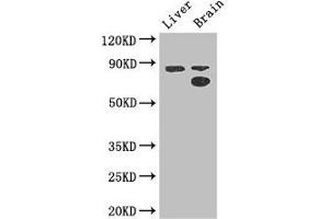 Western Blot Positive WB detected in: Mouse liver tissue, Mouse brain tissue All lanes: SMURF1 antibody at 3. (SMURF1 anticorps  (AA 198-374))