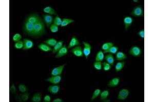 Immunofluorescence staining of Hela cells with ABIN7167118 at 1:133, counter-stained with DAPI. (RIN3 anticorps  (AA 245-465))
