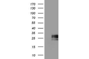 Western Blotting (WB) image for anti-Adiponectin (ADIPOQ) (AA 19-244) antibody (ABIN2715778) (ADIPOQ anticorps  (AA 19-244))