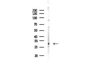 anti-NK6 Homeobox 2 (NKX6-2) antibody