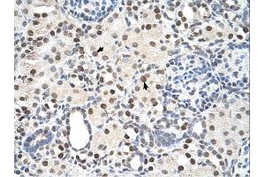 Immunohistochemistry with Tonsil tissue at an antibody concentration of 5µg/ml using anti-PSME3 antibody (ARP46142_P050) (PSME3 anticorps  (N-Term))