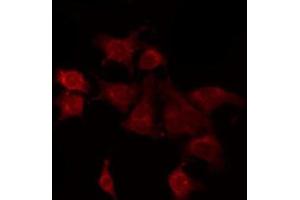 ABIN6266637 staining A549 by IF/ICC.