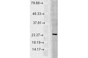 WB 1 in 1000 Huma Cell line mix 20ug Rab5. (RAB5 anticorps)