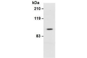 Western Blotting (WB) image for anti-Integrin beta 3 (ITGB3) antibody (ABIN1449278) (Integrin beta 3 anticorps)