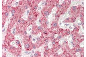 Rabbit Anti-BAAT antibody  Formalin Fixed Paraffin Embedded Tissue: Human Liver Primary antibody Concentration: 1:100 Secondary Antibody: Donkey anti-Rabbit-Cy3 Secondary Antibody Concentration: 1:200 Magnification: 20x Exposure Time: 0.