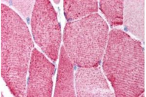 Human Skeletal Muscle (formalin-fixed, paraffin-embedded) stained with HDAC6 antibody ABIN214772 at 5 ug/ml followed by biotinylated goat anti-rabbit IgG secondary antibody ABIN481713, alkaline phosphatase-streptavidin and chromogen.