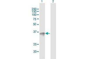 Western Blot analysis of SGCG expression in transfected 293T cell line by SGCG MaxPab polyclonal antibody. (SGCG anticorps  (AA 1-291))