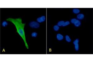 Immunofluorescence staining of HEK293 cells with Anti-Protein C (ABIN7487753) HPC-4 Immunofluorescence analysis of paraformaldehyde fixed HEK293 cells transfected with Protein C expressing plasmid (A) and non-transfected HEK293 cells (B), permeabilized with 0. (Recombinant PROC anticorps)