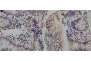 Immunohistochemistry of paraffin-embedded Mouse colon using IL10 Polyclonal Antibody at dilution of 1:50 (IL-10 anticorps)