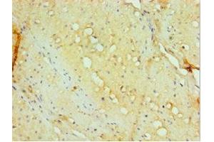 Immunohistochemistry of paraffin-embedded human small intestine tissue using ABIN7143885 at dilution of 1:100 (aHSP anticorps  (AA 1-102))