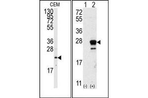 Image no. 1 for anti-GTPase NRas (NRAS) (N-Term) antibody (ABIN360038) (GTPase NRas anticorps  (N-Term))