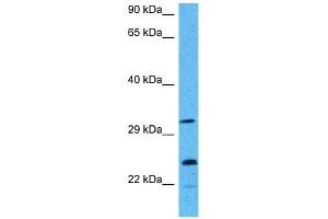 Host:  Mouse  Target Name:  AK2  Sample Tissue:  Mouse Testis  Antibody Dilution:  1ug/ml (Adenylate Kinase 2 anticorps  (Middle Region))