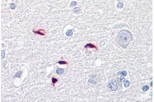 Anti-GLI1 antibody IHC staining of human brain, cortex. (GLI1 anticorps  (AA 940-990))
