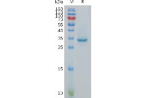 Human CT83 Protein, hFc Tag on SDS-PAGE under reducing condition.