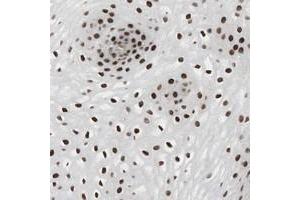 Immunohistochemical staining of human esophagus with GRHL1 polyclonal antibody  shows strong nuclear positivity in squamous epithelial cells at 1:50-1:200 dilution. (GRHL1 anticorps)