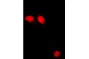 Immunofluorescent analysis of Troponin C staining in U2OS cells. (Troponin C anticorps)