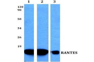 Western blot (WB) analysis of RANTES Antibody at 1/500 dilution.