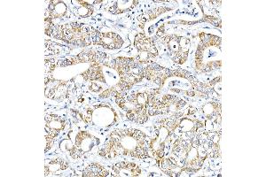 Immunohistochemistry of paraffin-embedded Human liver using RMDN3 Rabbit pAb (ABIN6127274, ABIN6146979, ABIN6146981 and ABIN6221512) at dilution of 1:100 (40x lens). (RMDN3 anticorps  (AA 171-470))