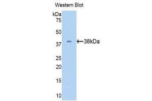 Western Blotting (WB) image for anti-Lactate Dehydrogenase B (LDHB) (AA 1-334) antibody (ABIN1174942) (LDHB anticorps  (AA 1-334))