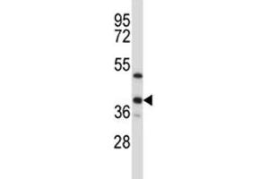 ERCC1 antibody western blot analysis in T47D lysate