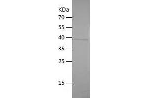 Western Blotting (WB) image for Tumor Necrosis Factor (Ligand) Superfamily, Member 14 (TNFSF14) (AA 71-240) protein (His-IF2DI Tag) (ABIN7125530)